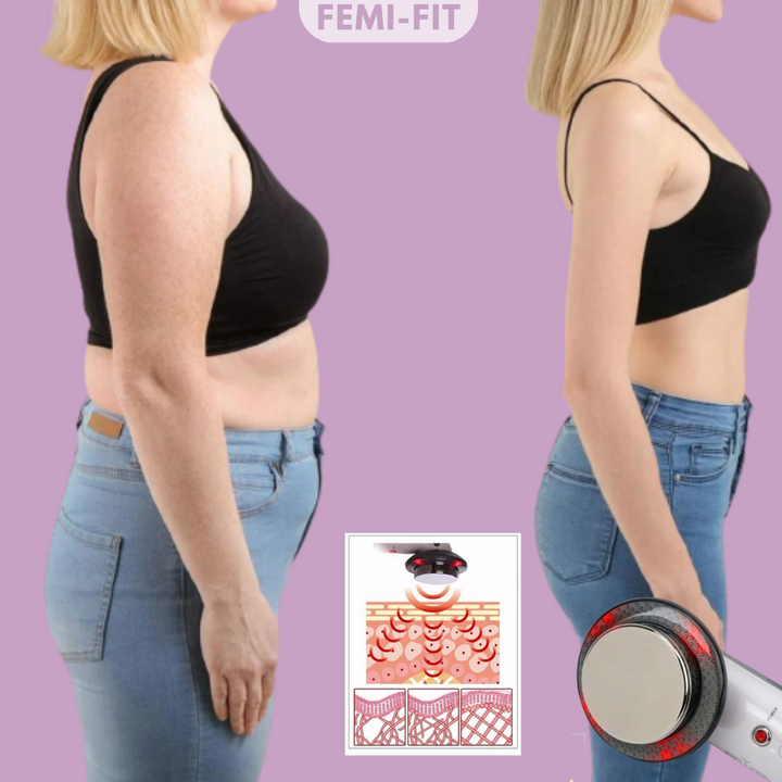 3-in-1 Fat & Cellulite Remover - SlimShape-State of Style