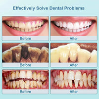 Ultrasonic Tooth Cleaner - SonicClean-White-State of Style
